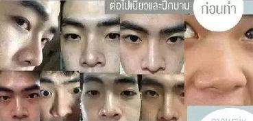 网红有钱丑男图